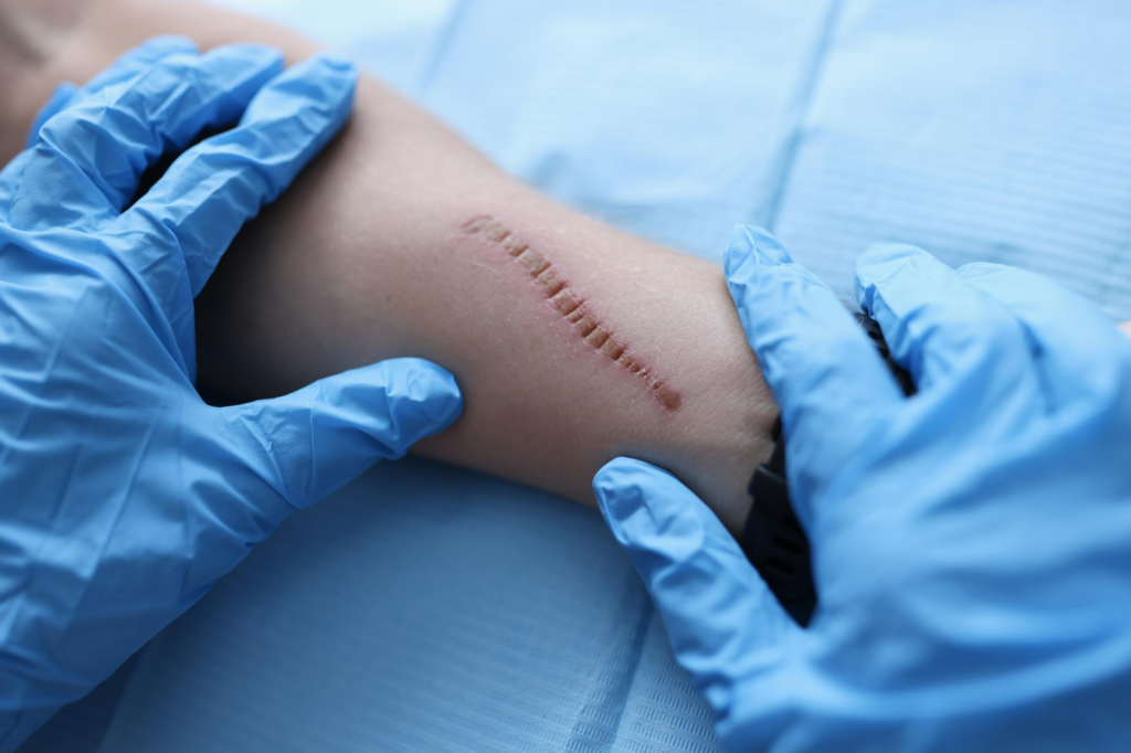 Scar Revision Surgery: Improve Skin Appearance & Reduce Visible Scars
