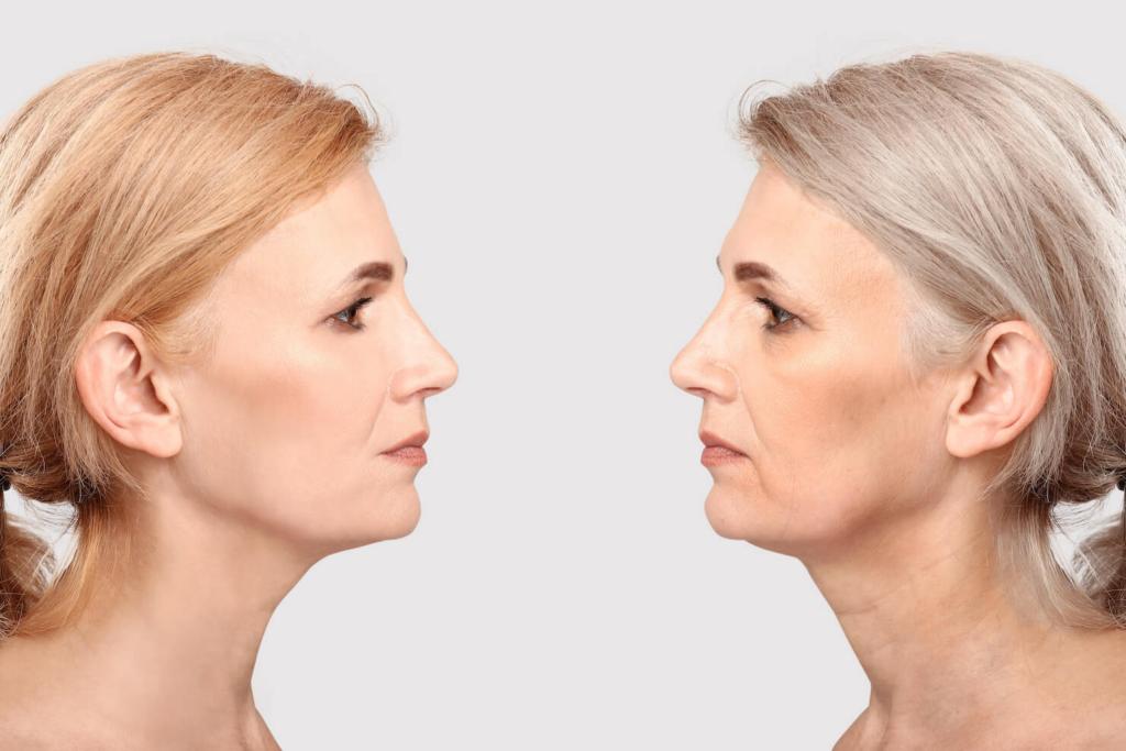 Anti-Aging Treatments: Surgical vs Non-Surgical Options Explained