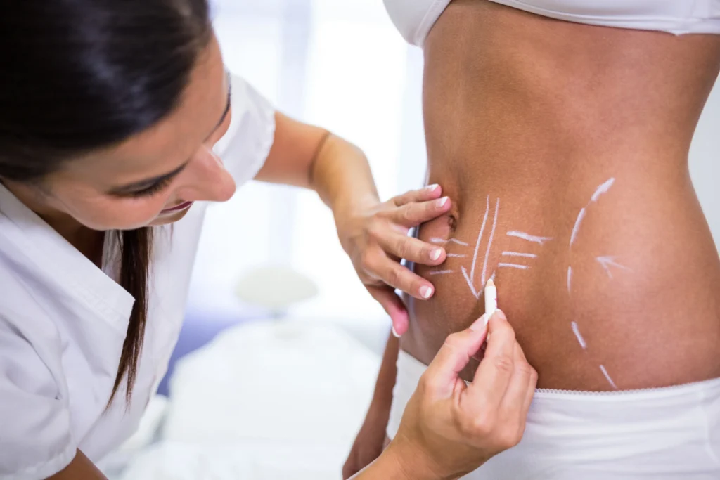 Can Cosmetic Surgery Help After Major Weight Loss?