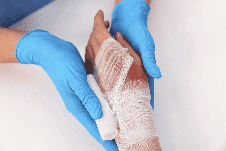 first-hour-after-burn-injury-what-to-do