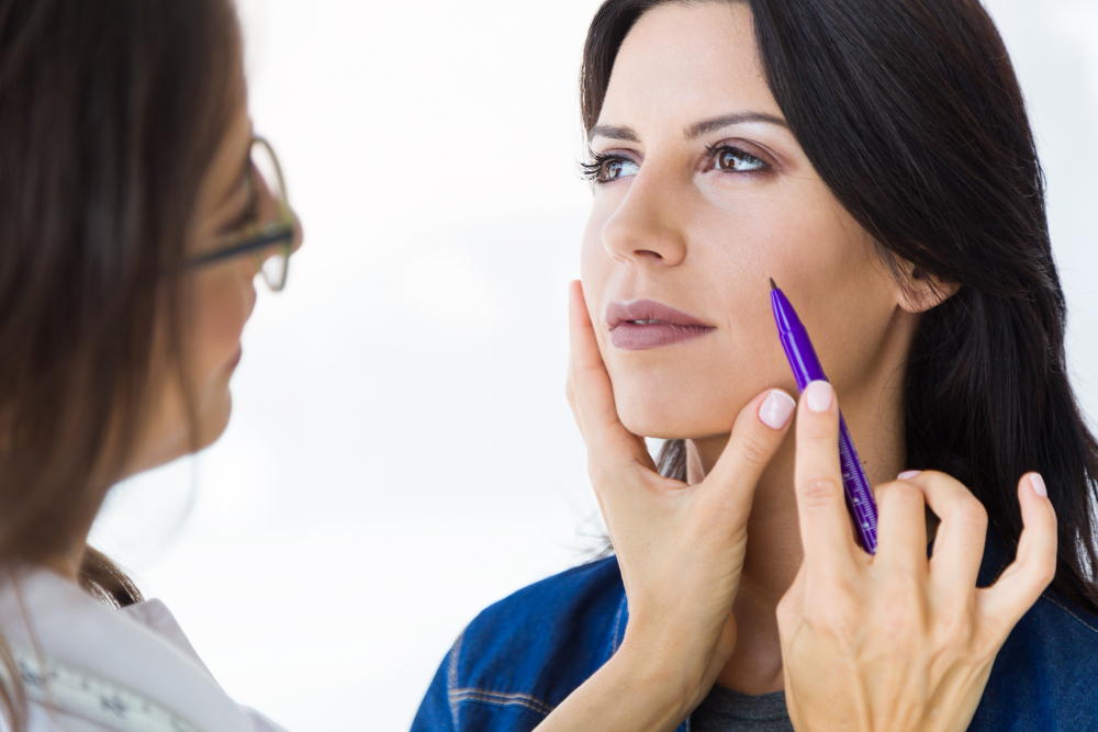 Deep plane facelift benefits
