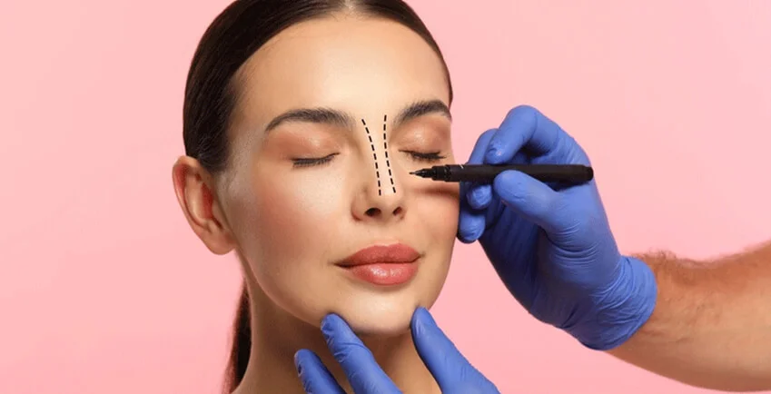 Rhinoplasty Before and After: Realistic Results & Expectations