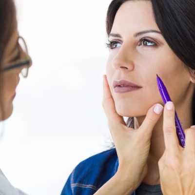 Deep plane facelift benefits