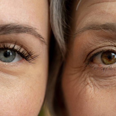 Who Is the Ideal Candidate for Cosmetic Surgery? Complete Guide