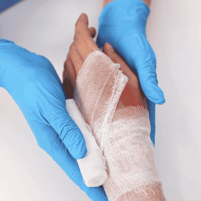 first-hour-after-burn-injury-what-to-do