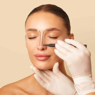 10 Benefits of Cosmetic Nose Surgery Beyond Appearance
