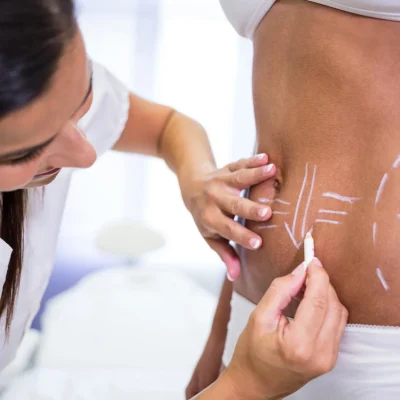 Can Cosmetic Surgery Help After Major Weight Loss?